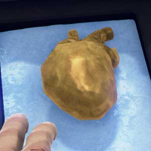 Surgeon Simulator 2013 - Extraterrestre